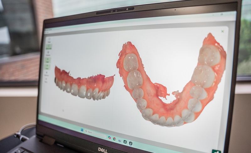 a laptop near a window showing prosthetic denture model