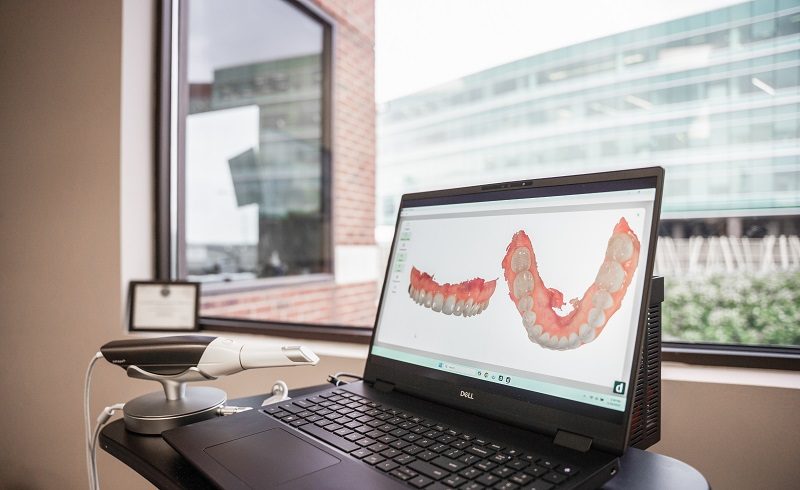 a laptop near a window showing prosthetic denture model