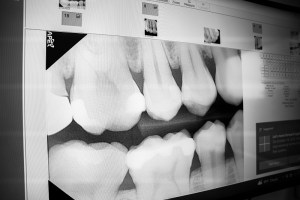 a laptop near a window showing x-ray result